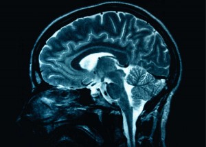 mind